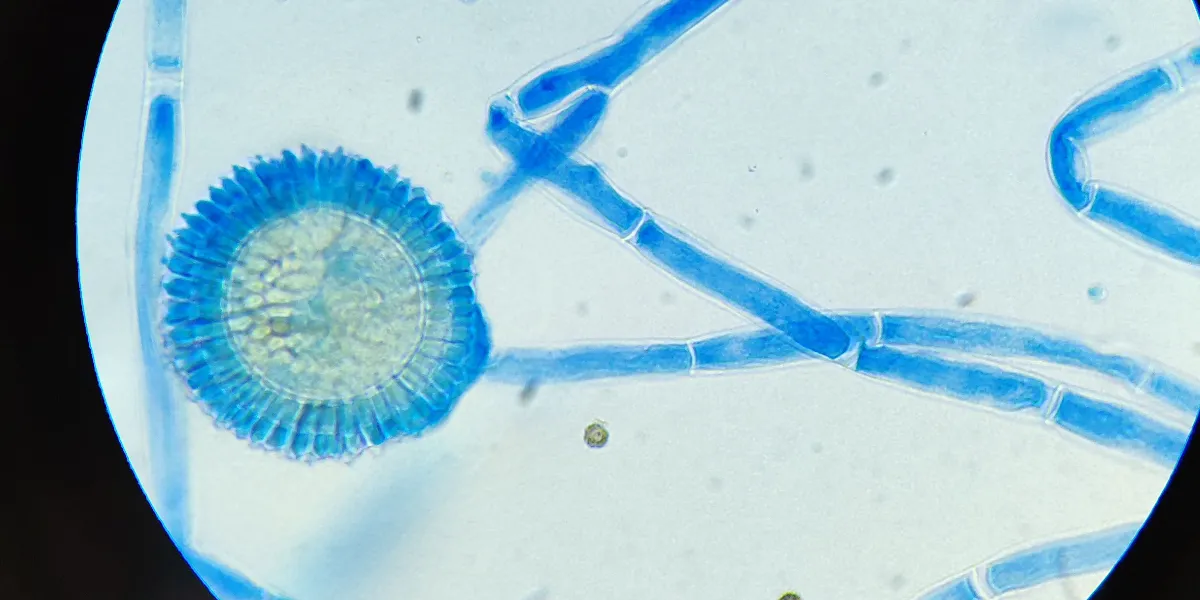 Fungal hyphae and spores through a microscope